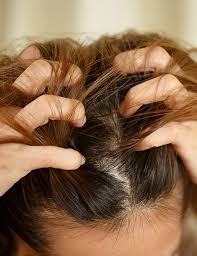 Démangeaisons du cuir chevelu